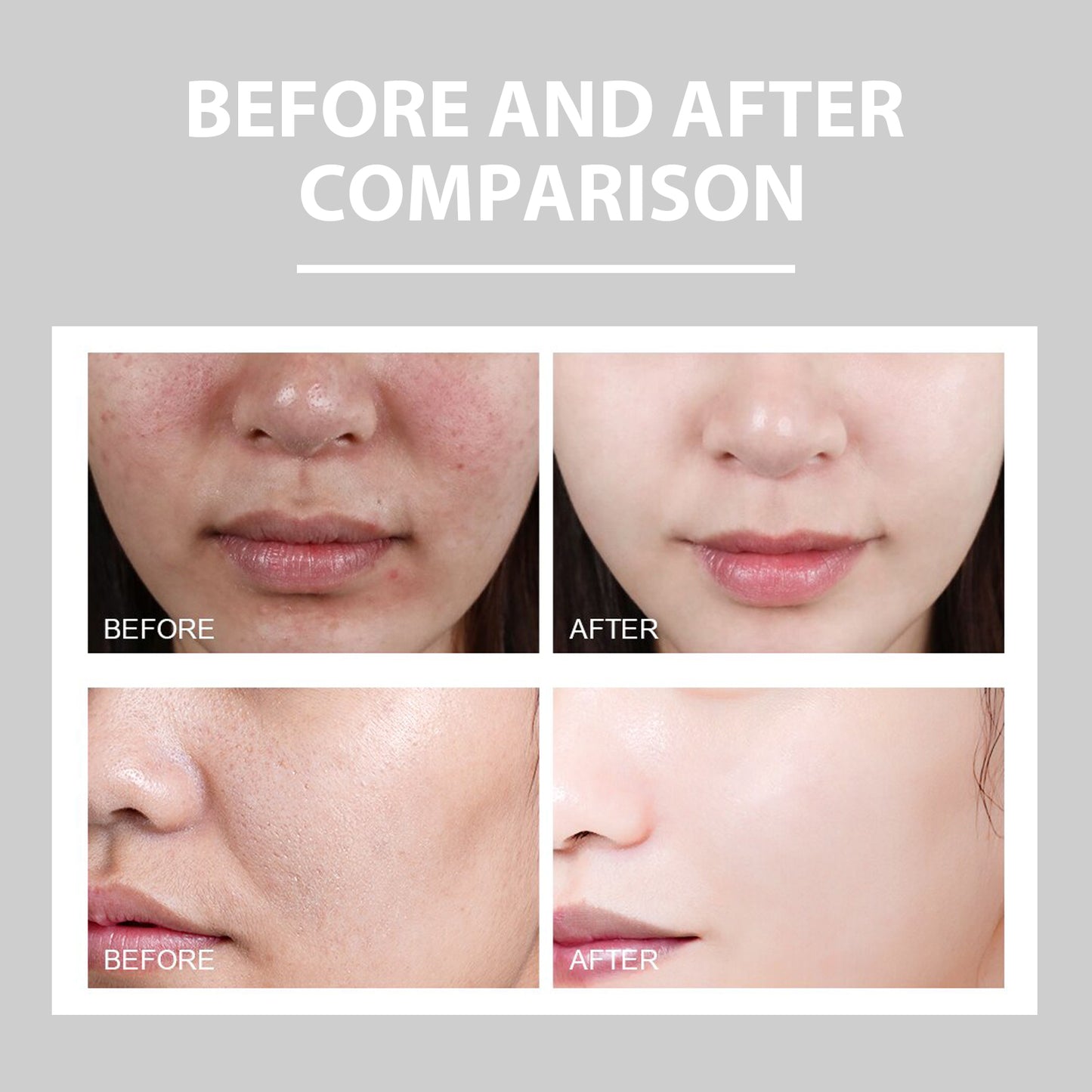 Eelhoe Hydrating Cream Hydrating And Lightening Facial Acne Repair Redness Hydrating And Brightening Moisturizing Cream